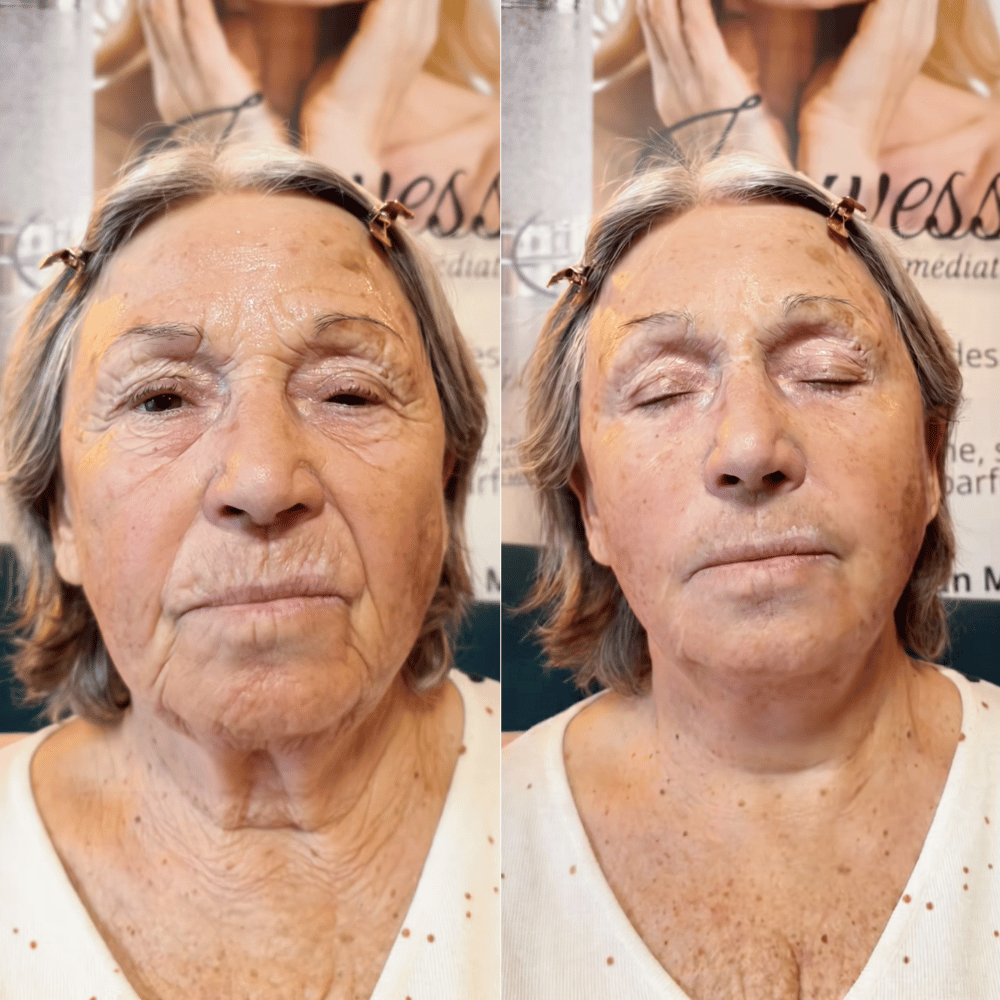 Prima e dopo con Velvionna K-Lift