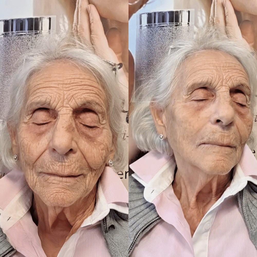Before and after with Sereia K-Lift