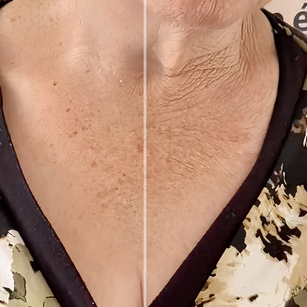 Before and after