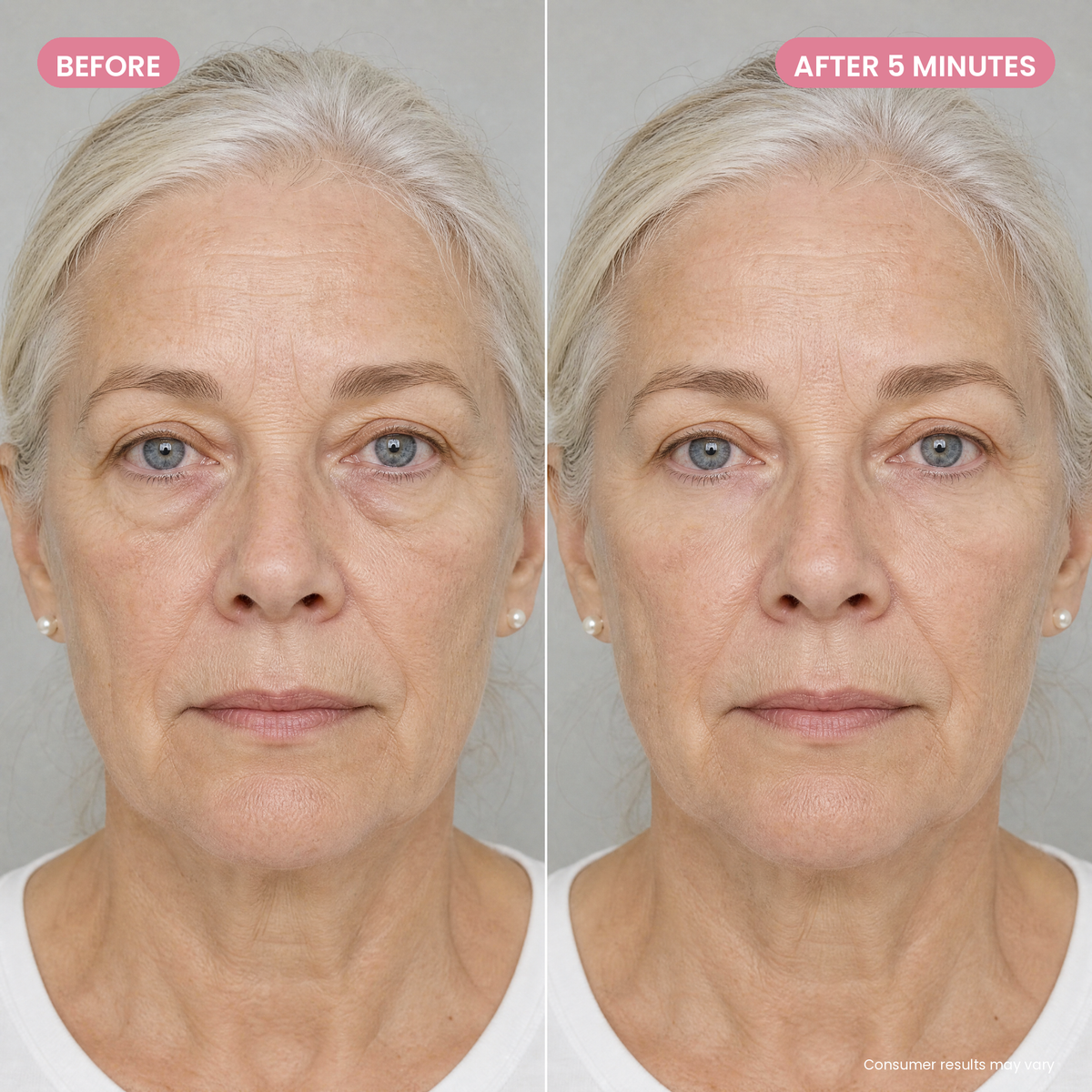 Before and after 5 minutes: under-eye bags flattened, same woman