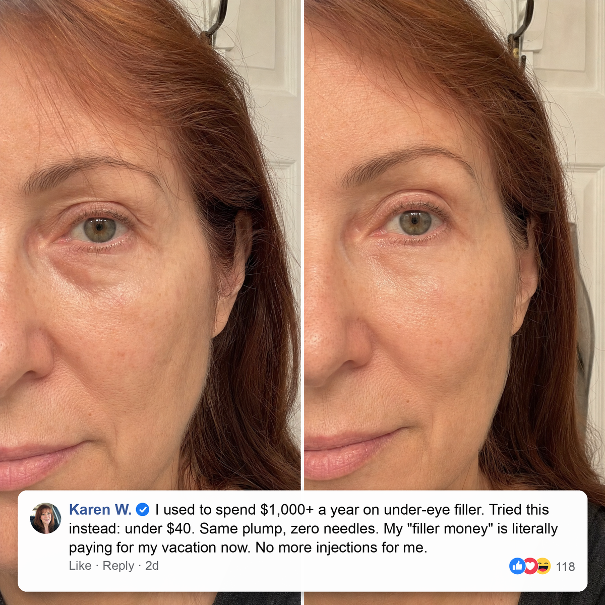 Customer story: under $40 instead of $1,000+ a year on filler