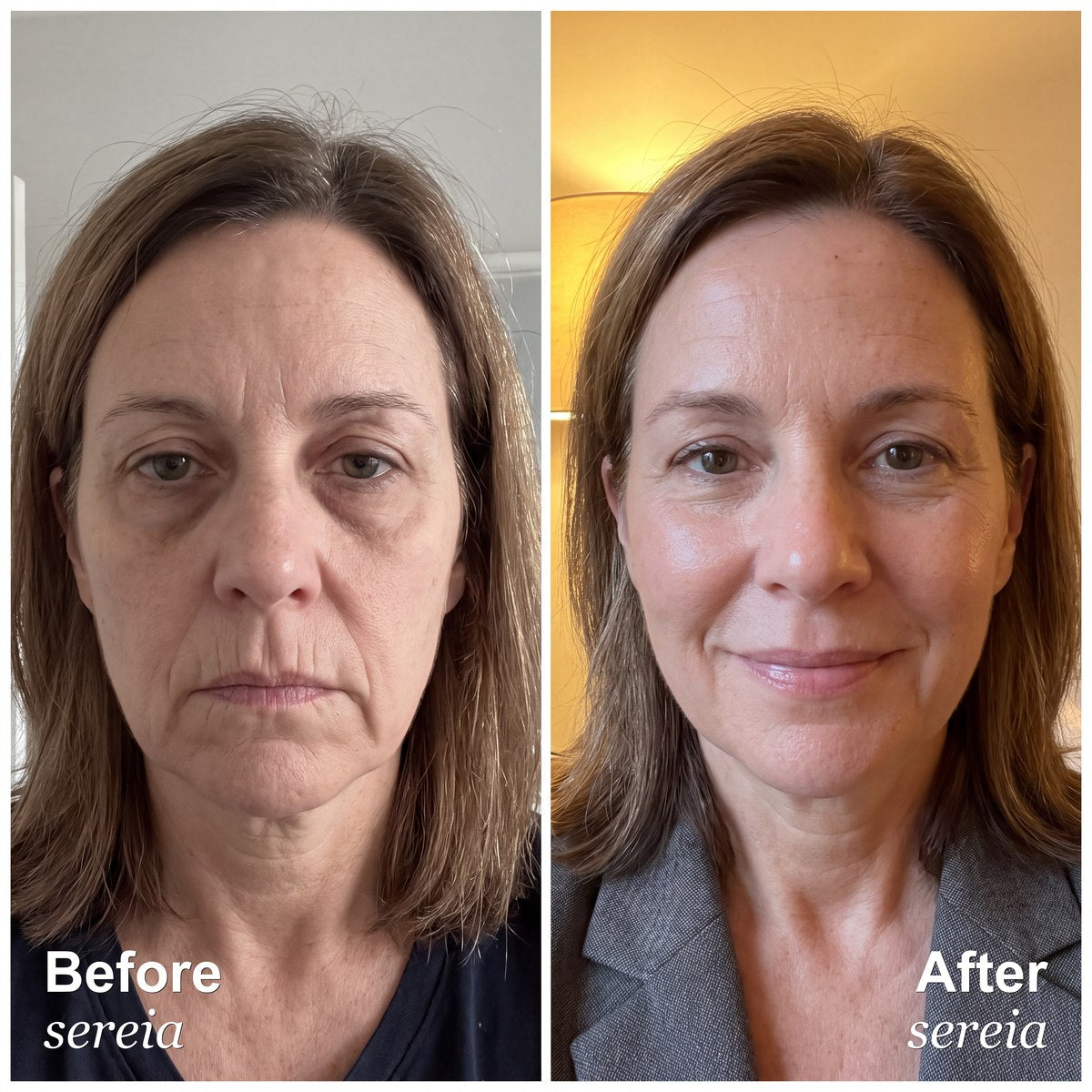 Before and after sereia
