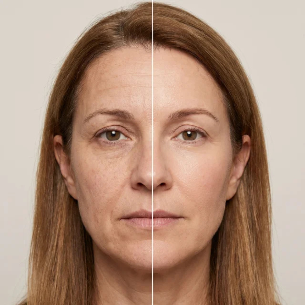 Before and after