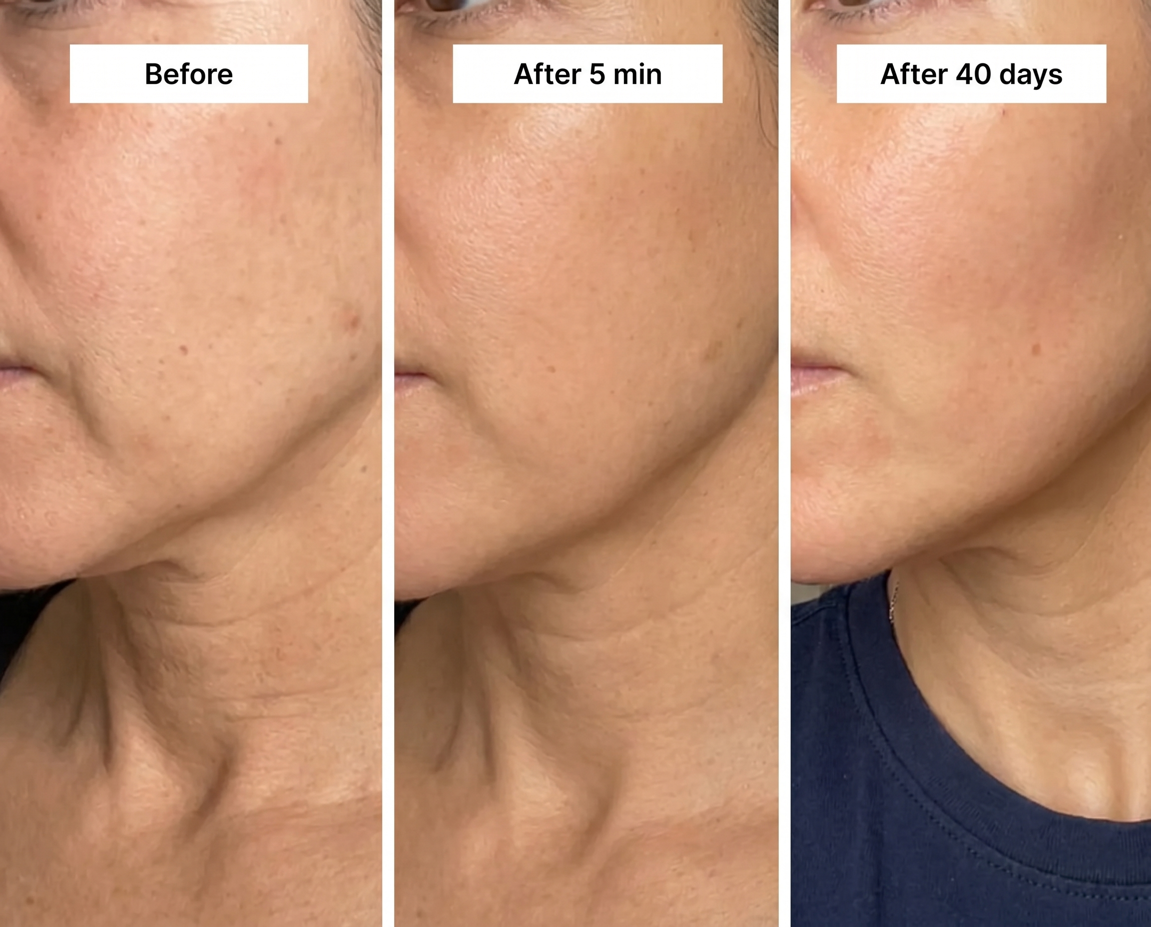 Before, after 5 minutes, after 40 days