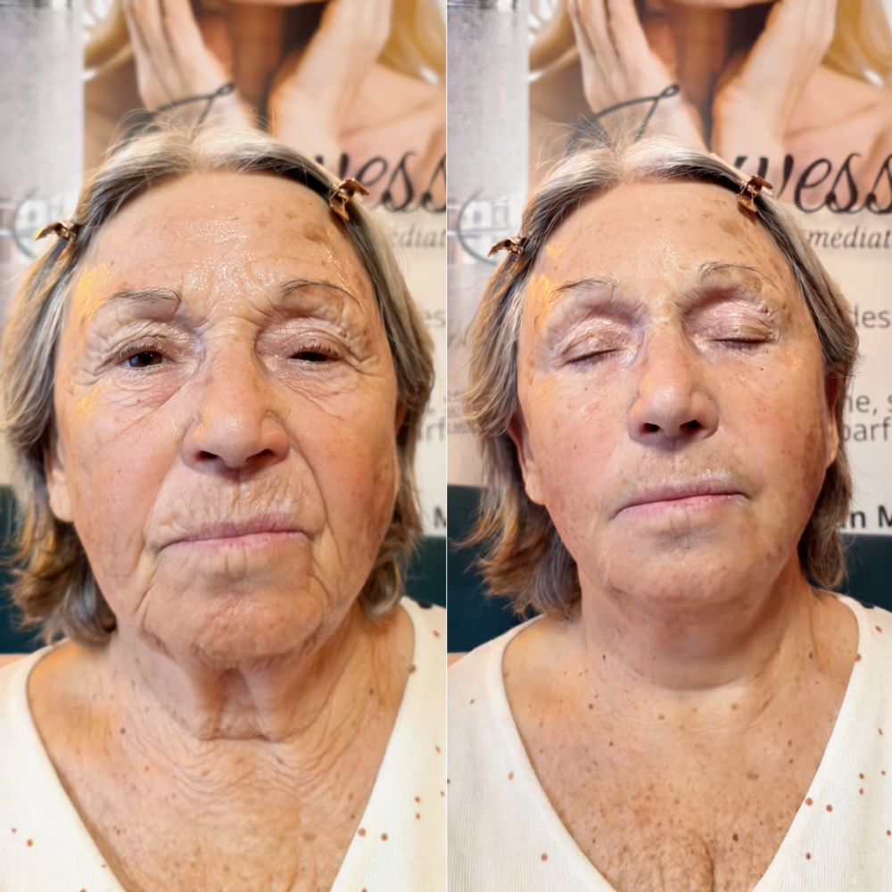 Before and after