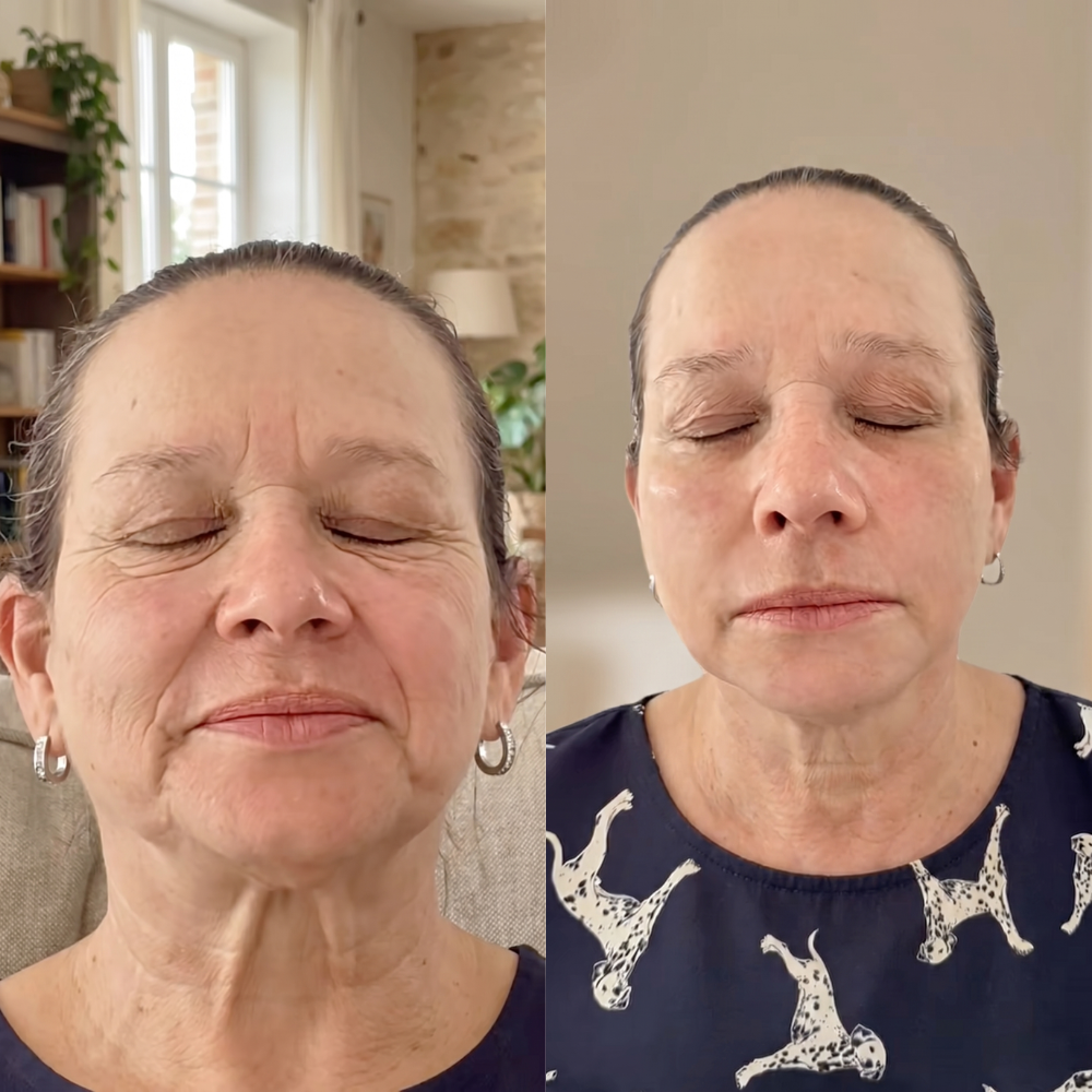 Before and after